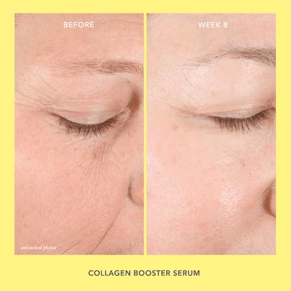 Collagen Booster