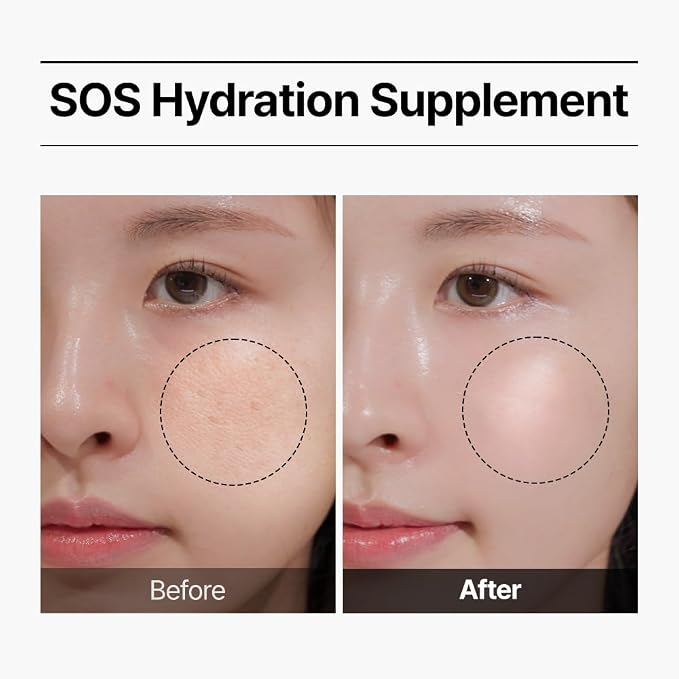 Hyaluronic Acid
