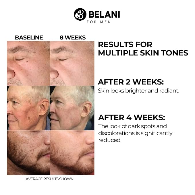 A. 1 Serum