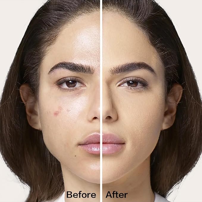 P01 for Dry Skin