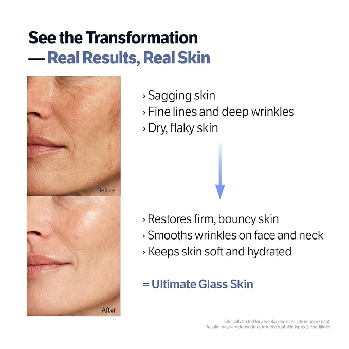 Retinol