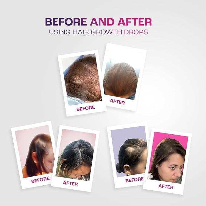 Hair Growth Drops