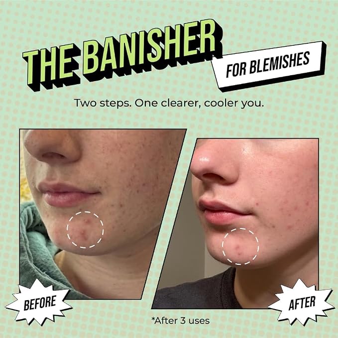 2-Step Treatments