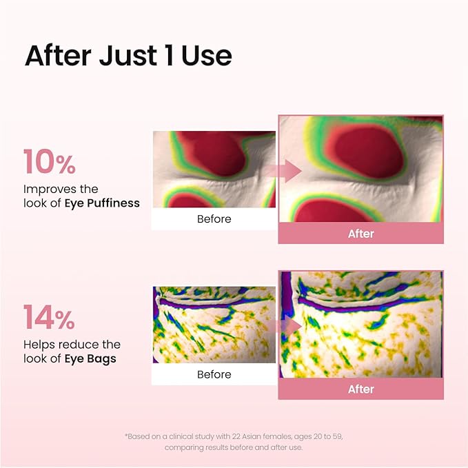 Collagen