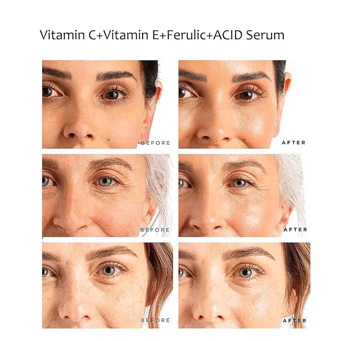 C+E Ferulic