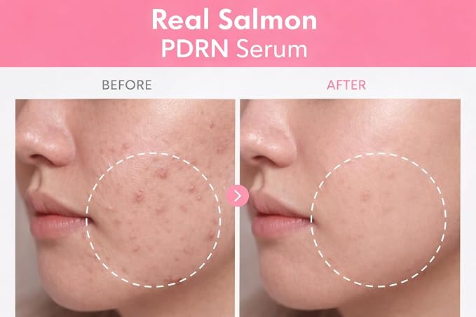 PDRN & Peptide Complex