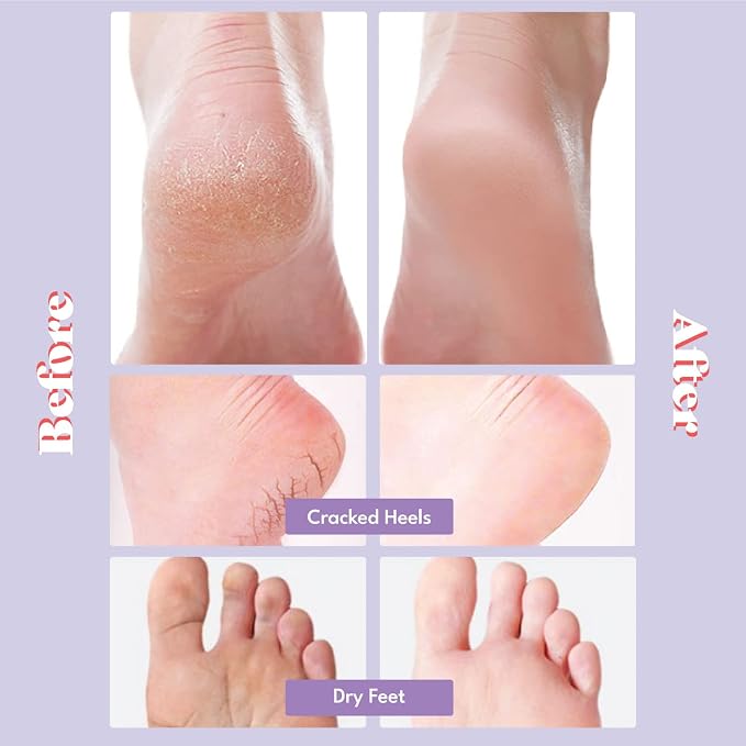 Moisturizing Socks-5pairs