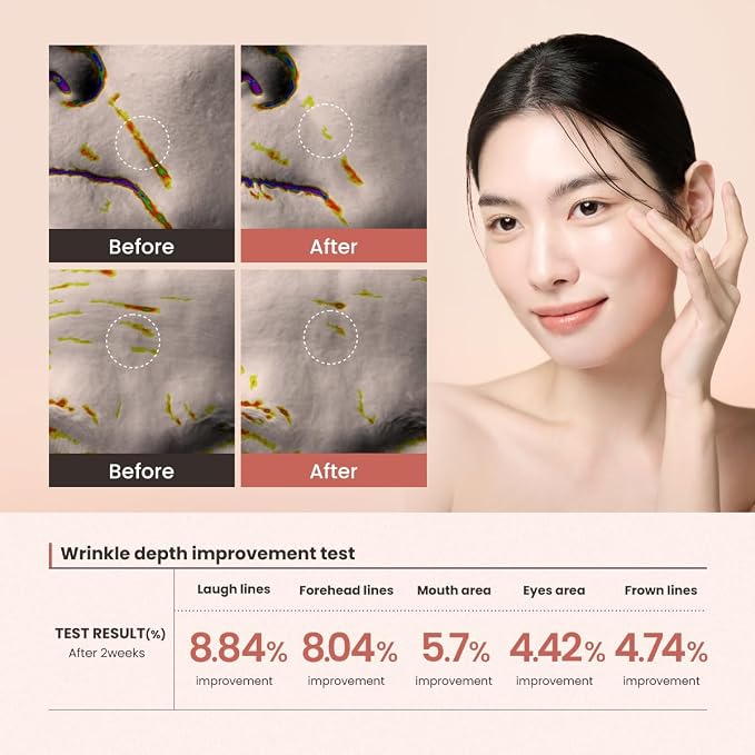 Lifting Serum