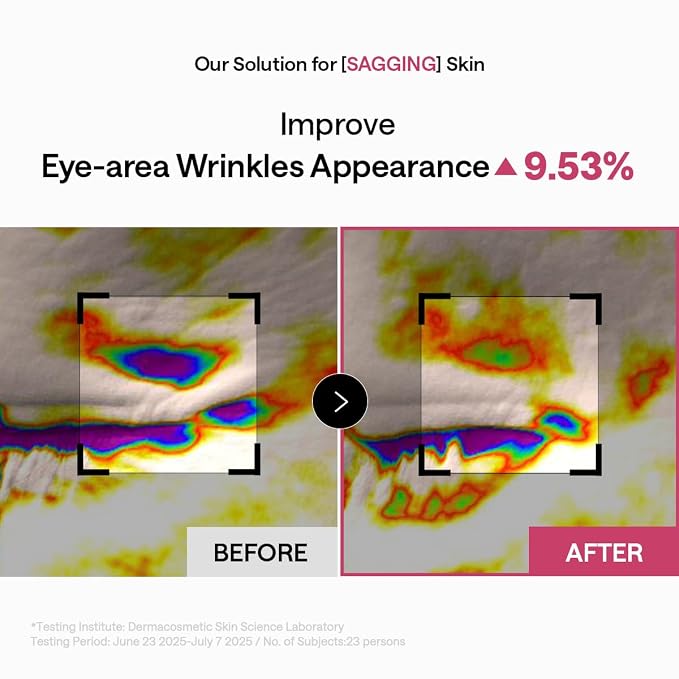 Retinol