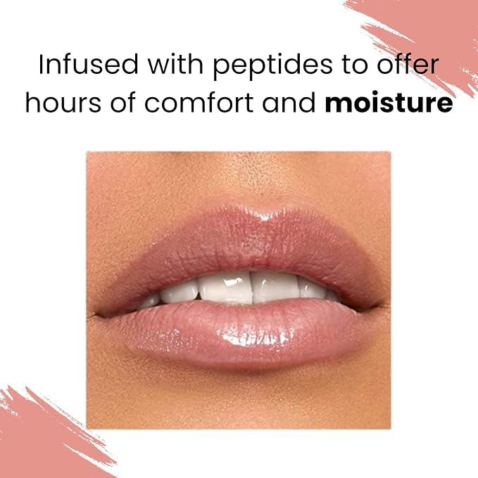 Affection