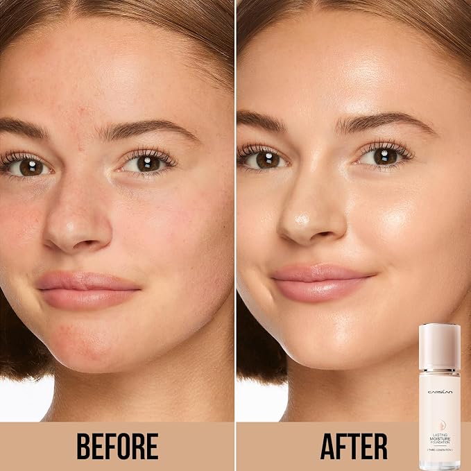 N01 for Dry Skin