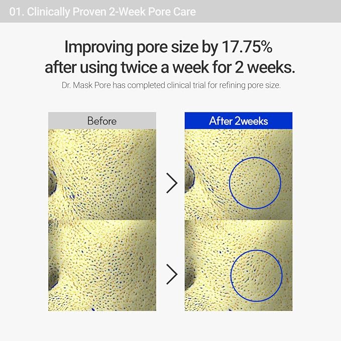 Sebum Control