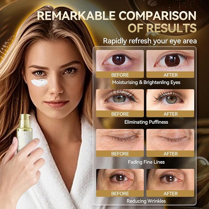EYE CARE KIT