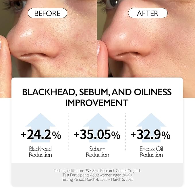Pore Control