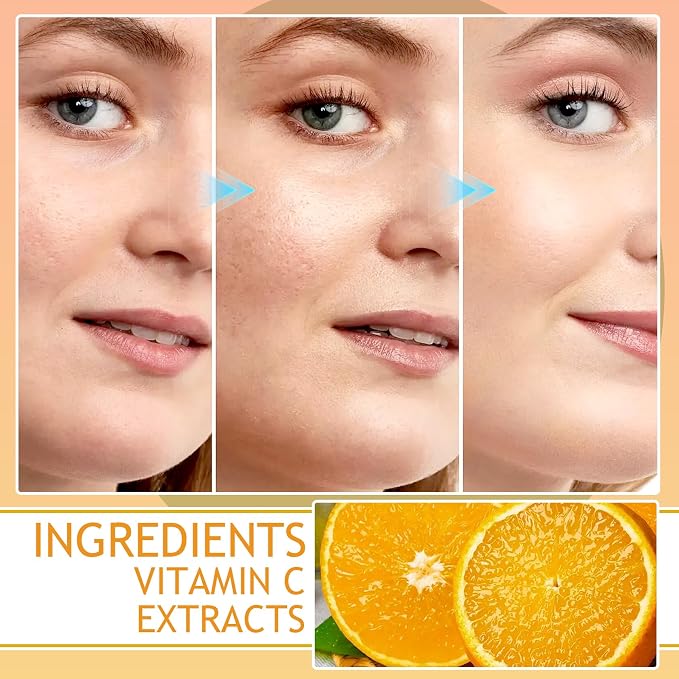 Vitamin C