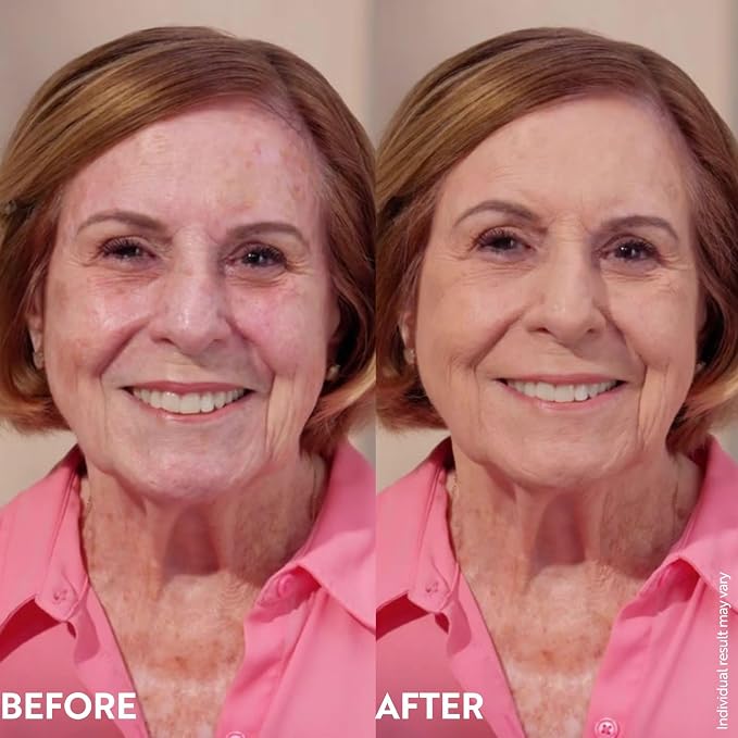 Light to medium skin tones