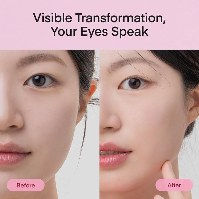 Collagen