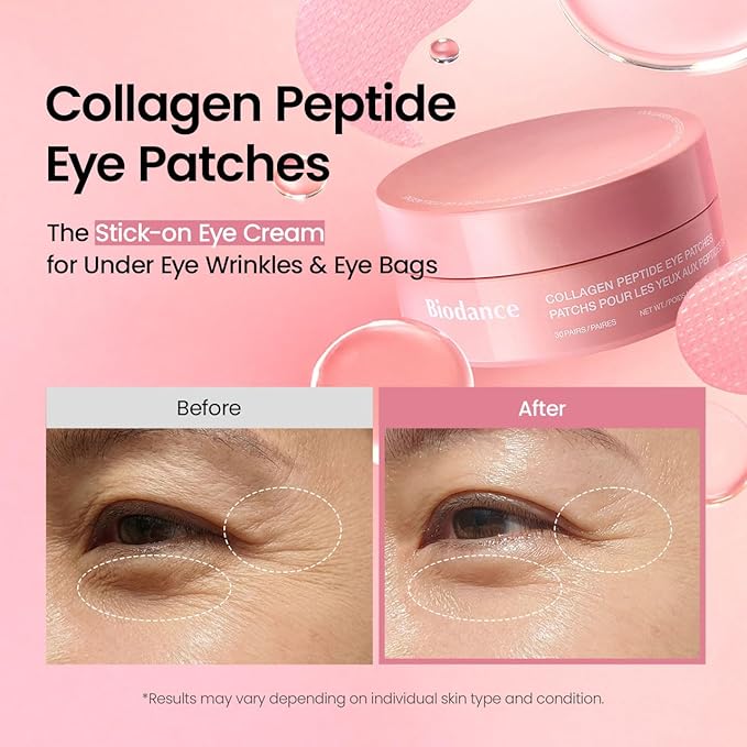Collagen