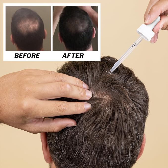 Men's Regrowth Kit