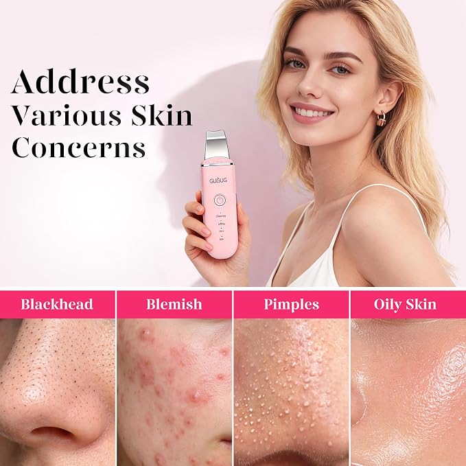 Y-pink