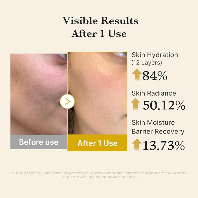 Kojic Acid Turmeric