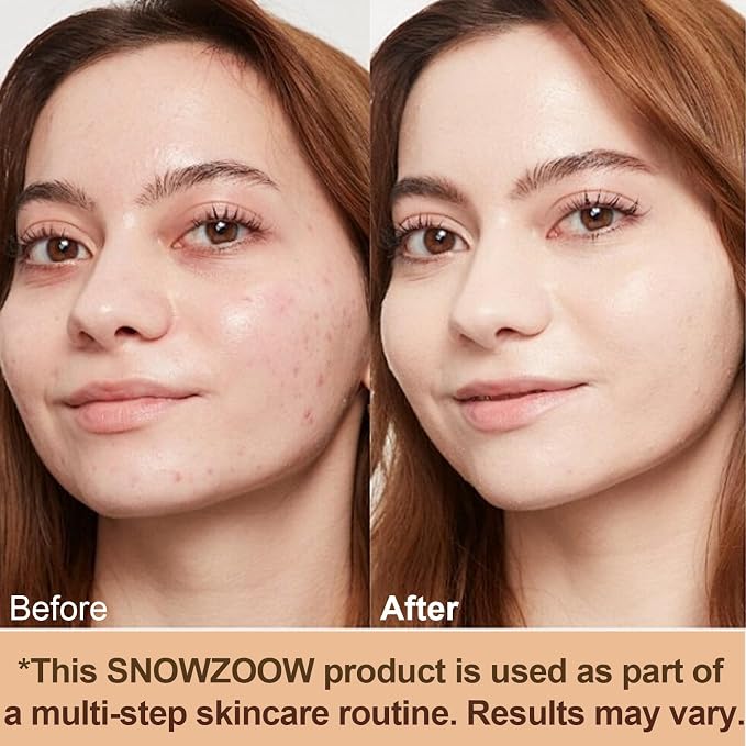 Medium Spectrum -Gold Lid- for people with fair skin