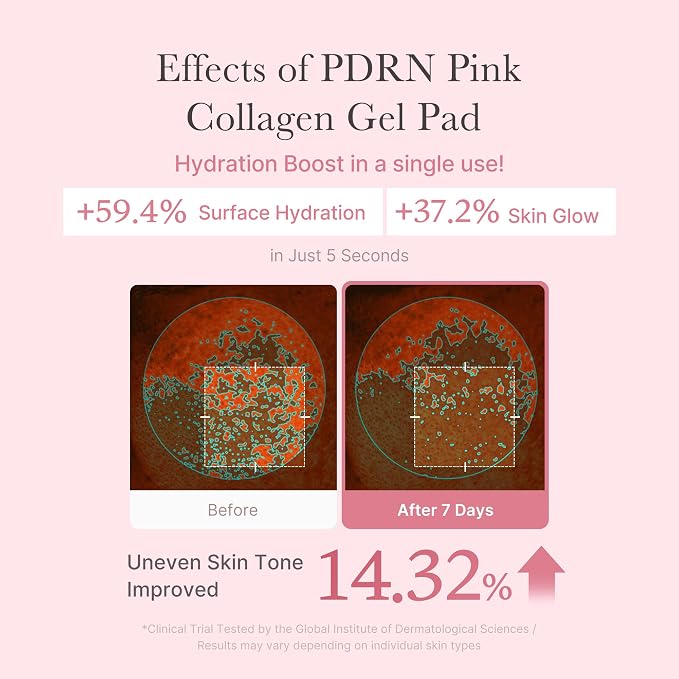 Pdrn Jelly Gel Pads