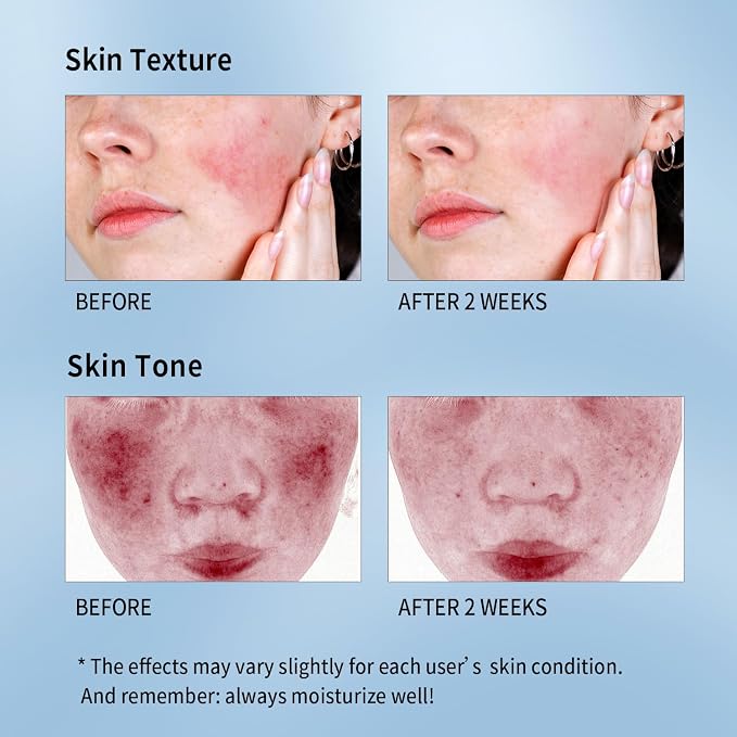 Calming Mask