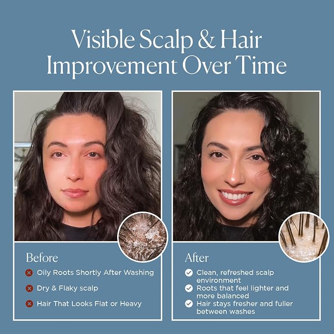 Red Label Shampoo for Oily Scalp