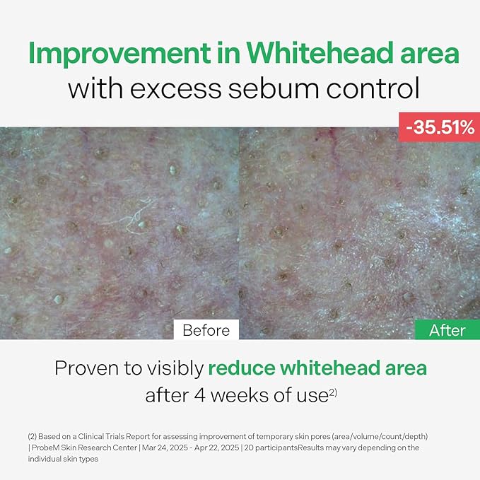 Control Serum 50ml (1.69 fl.oz.)