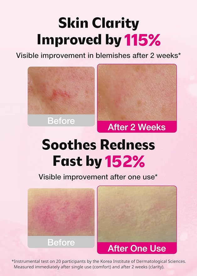 Blemish Care