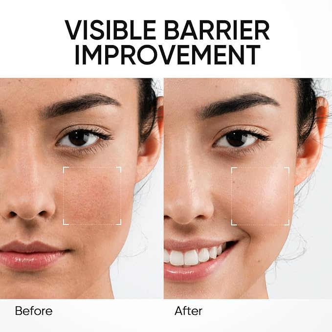 Repairing Light Texture