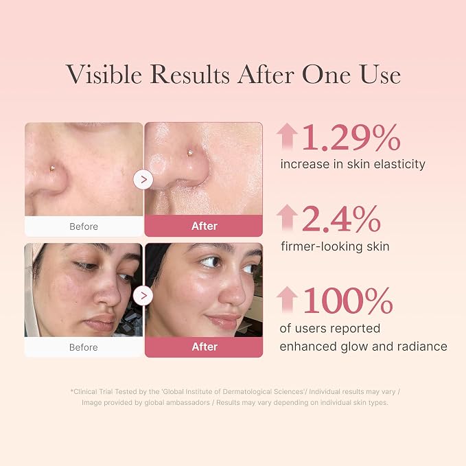 Collagen