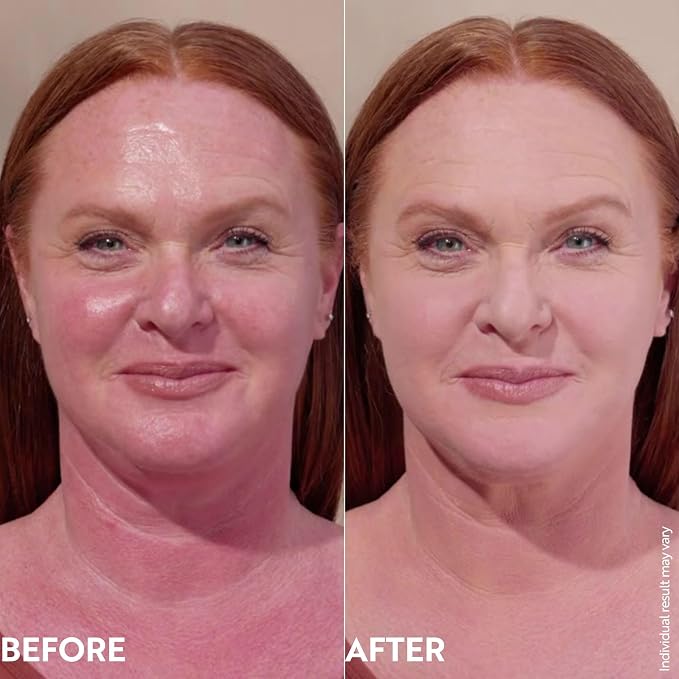Light to medium skin tones