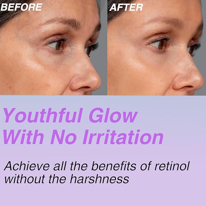 with Volufiline