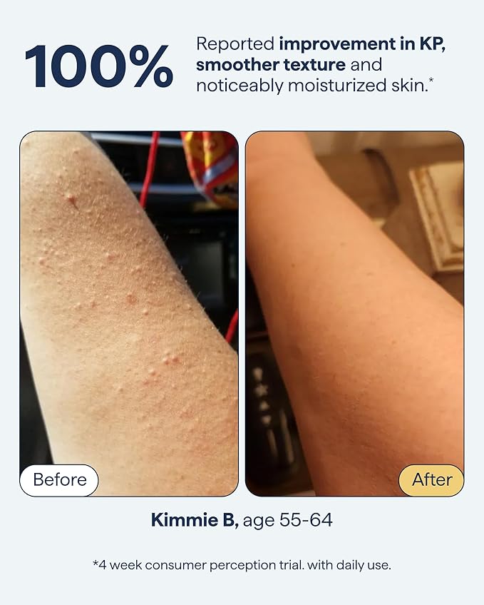 KP Exfoliating Body Moisturizer