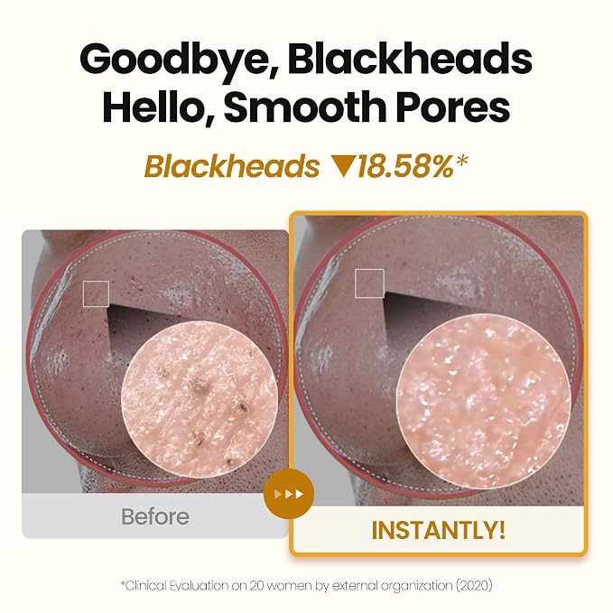 PuriteaToc