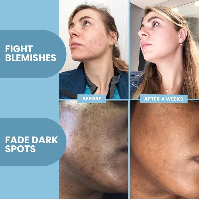 __DEFAULT__