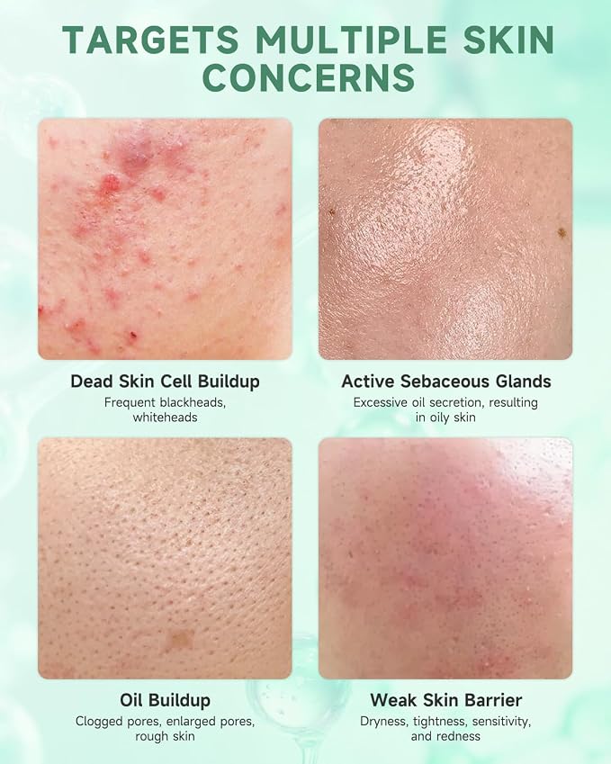 Treatment Soothing Essence