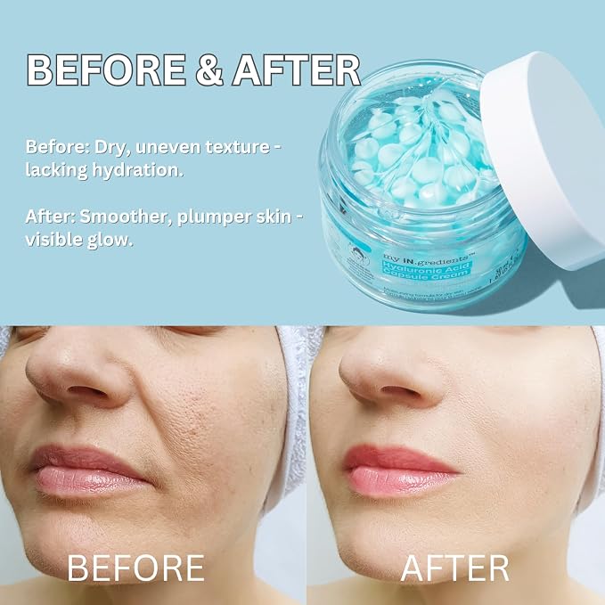 Hyaluronic Acid Capsule Cream