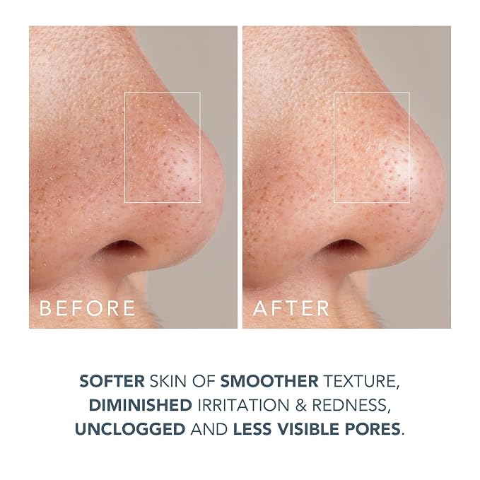 Kiwi Derma Set