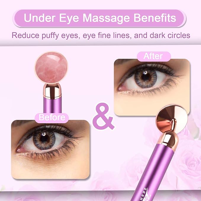 B: Upgrade Vibrating Rollers(purple)