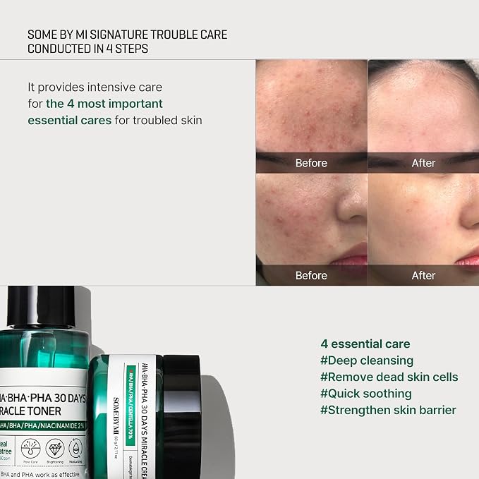 Miracle Kit with Bar