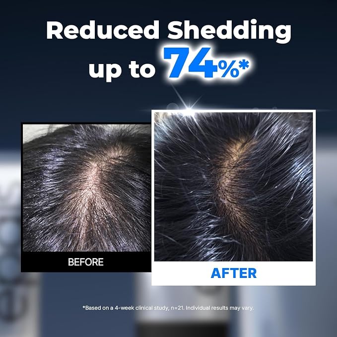 Full Scalp Care (Pack of 2)
