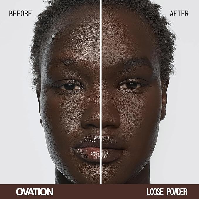 OVATION