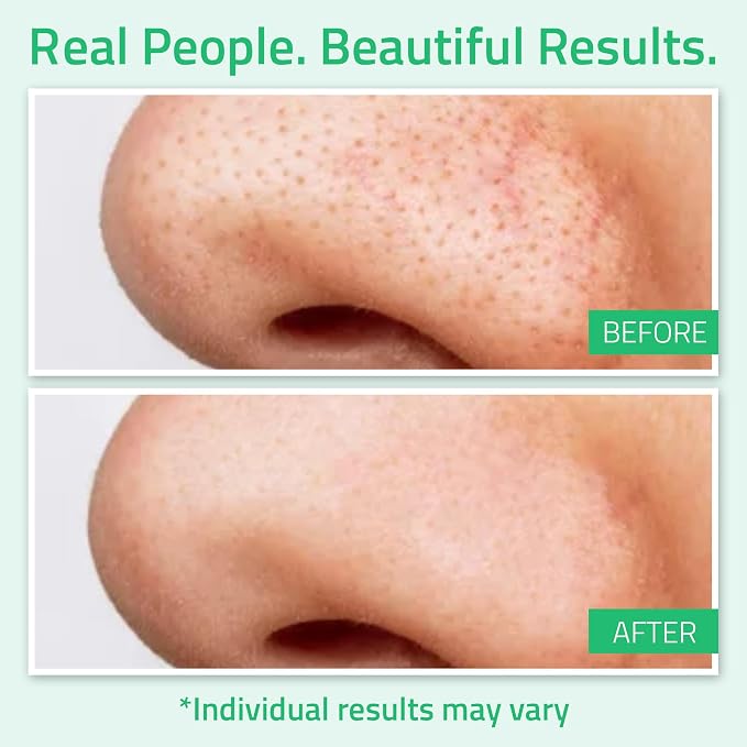 Glycolic Toner 8% 6oz