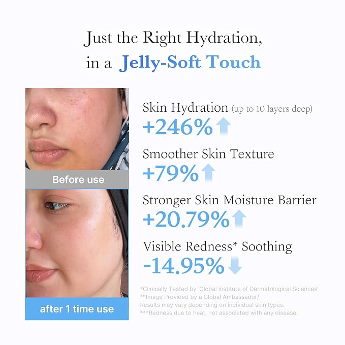 Hyaluronic Acid