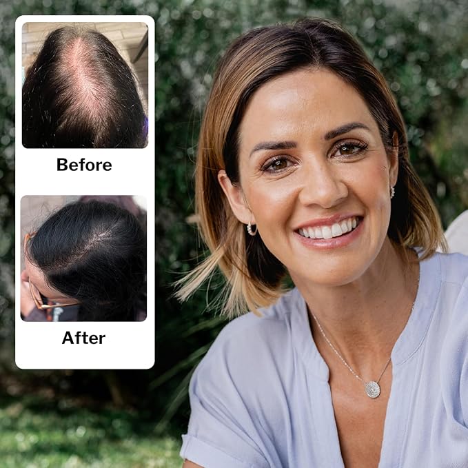 Women's Regrowth Kit