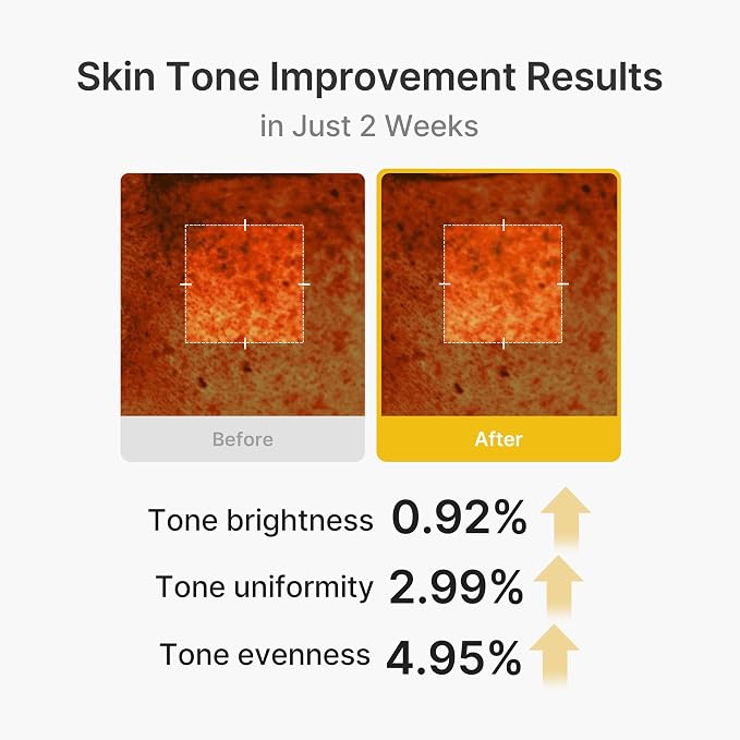 Kojic Acid Turmeric