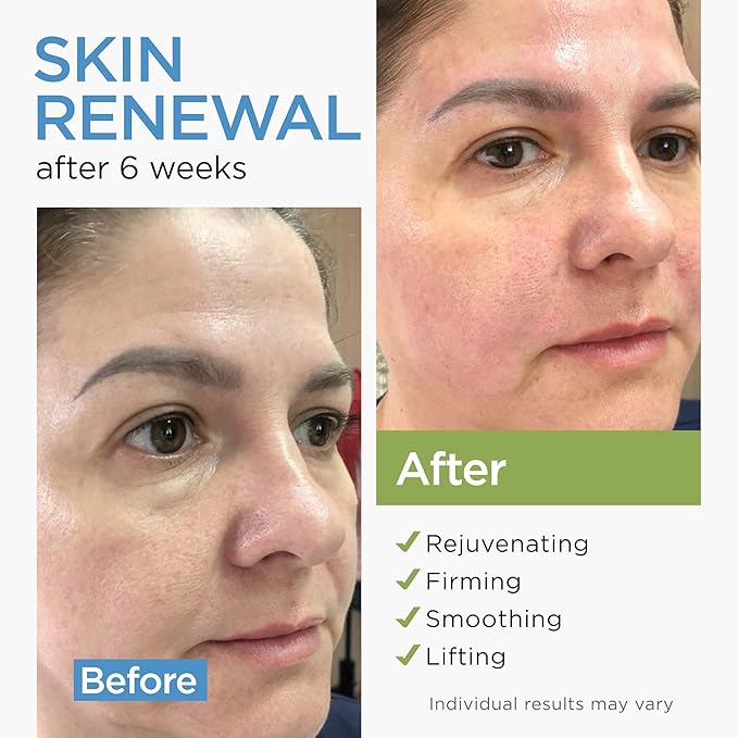Collagen Stem Cell
